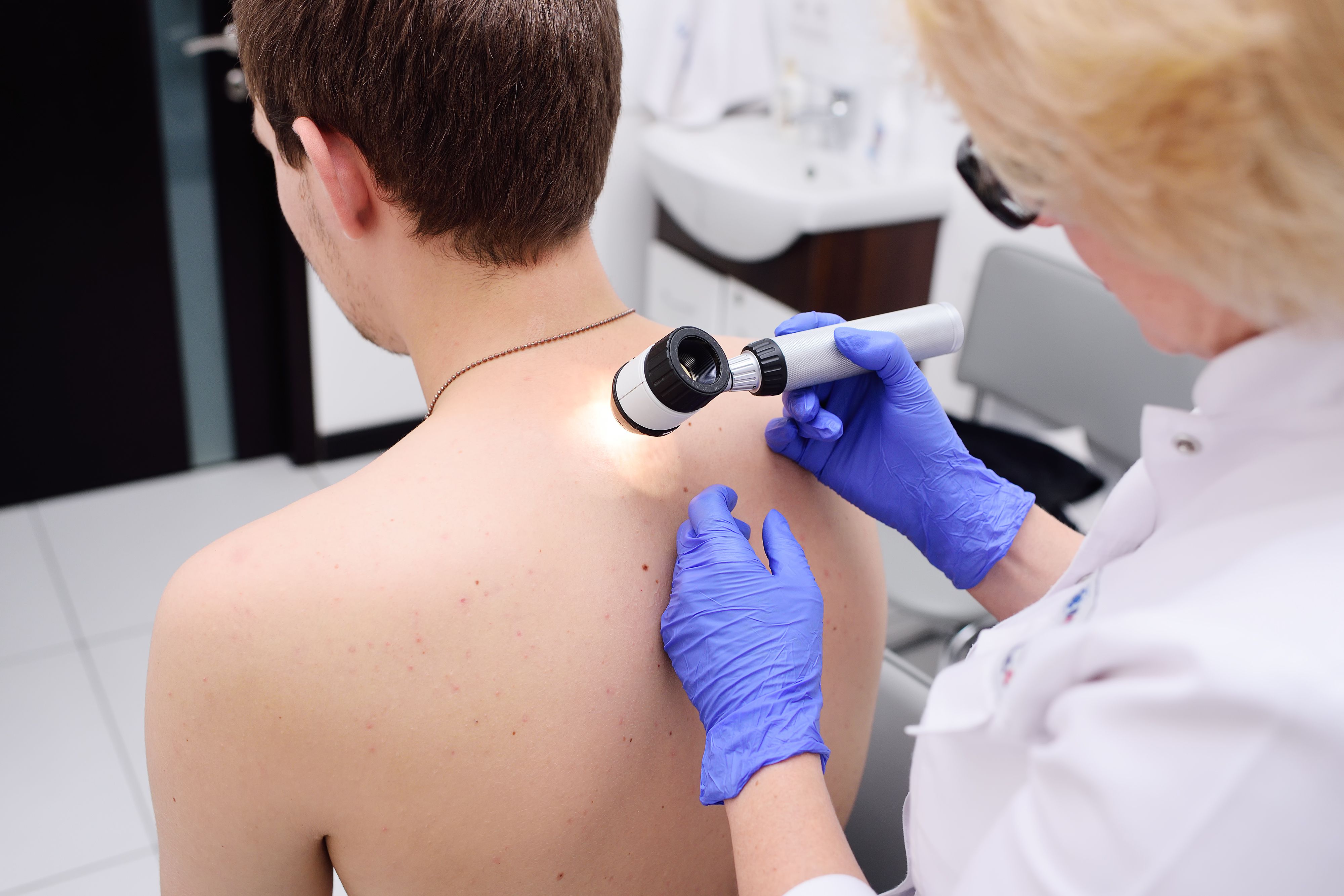 Free Melanoma Discovery Day October 11, 2021