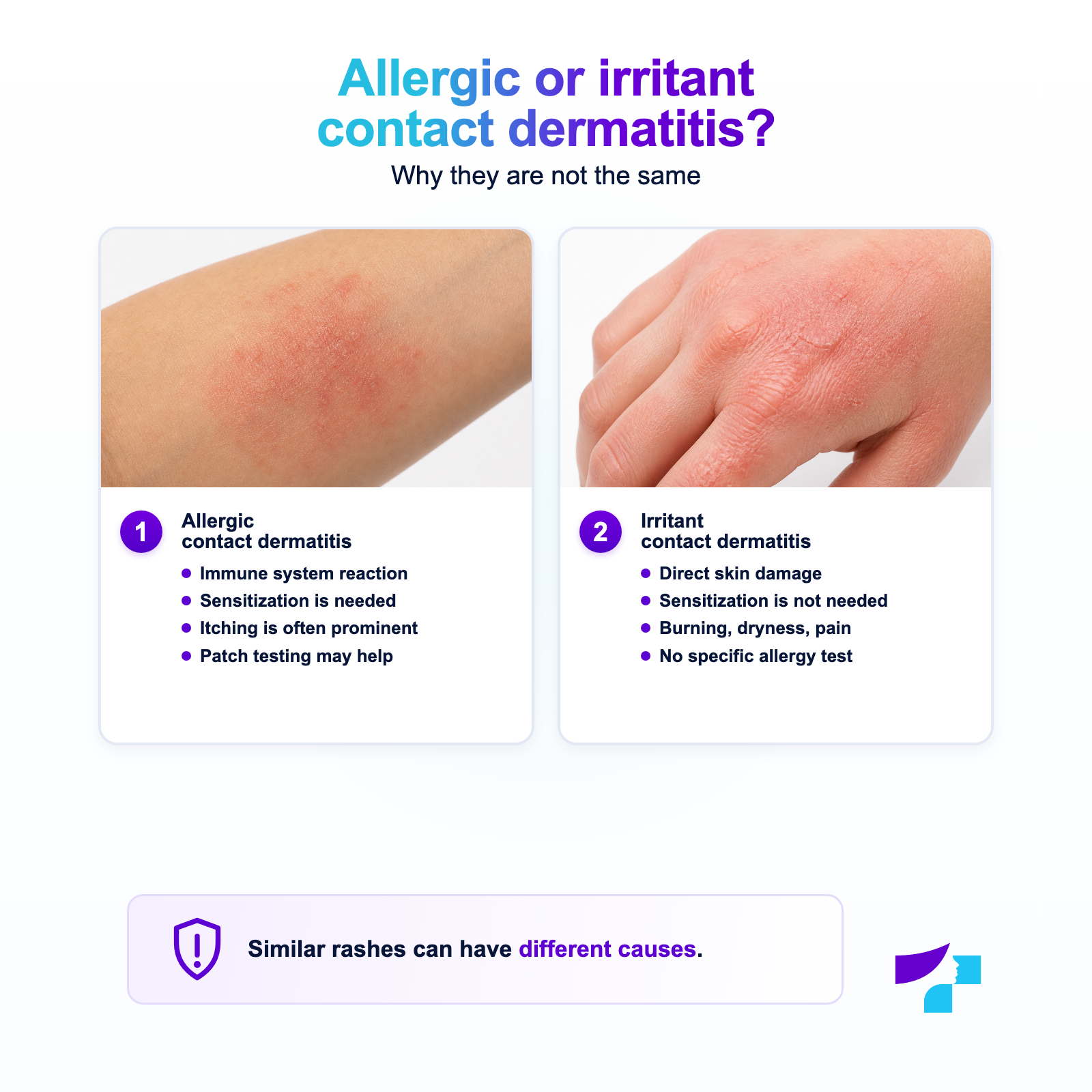 Differences, triggers and diagnosis of allergic and irritant contact dermatitis