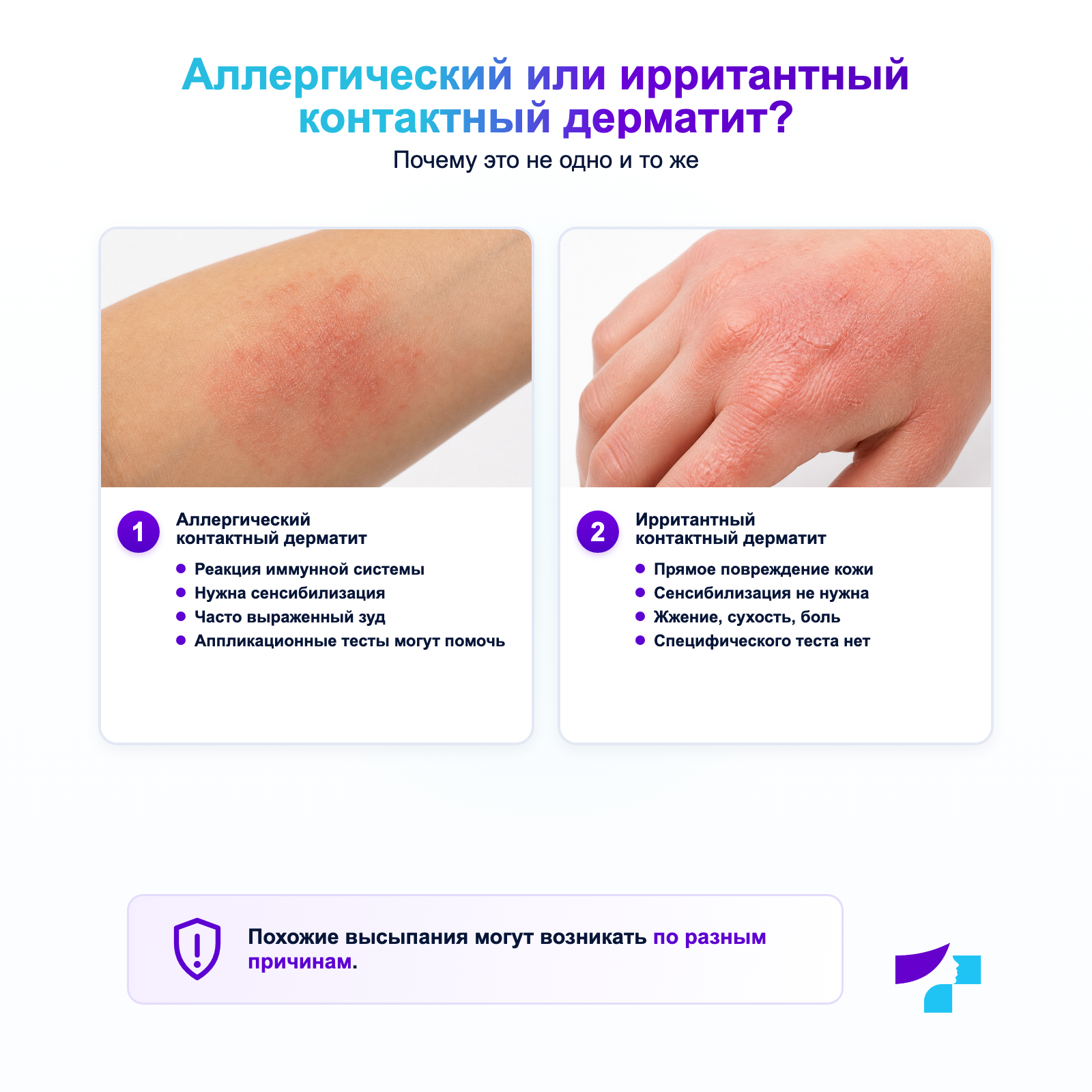 Аллергический или ирритантный контактный дерматит Различия, причины и диагностика аллергического и ирритантного контактного дерматита