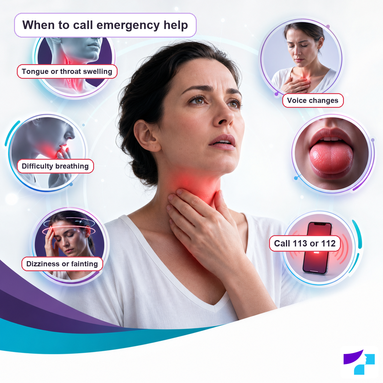 When to call emergency help for angioedema: tongue or throat swelling, difficulty breathing, voice changes, dizziness or fainting