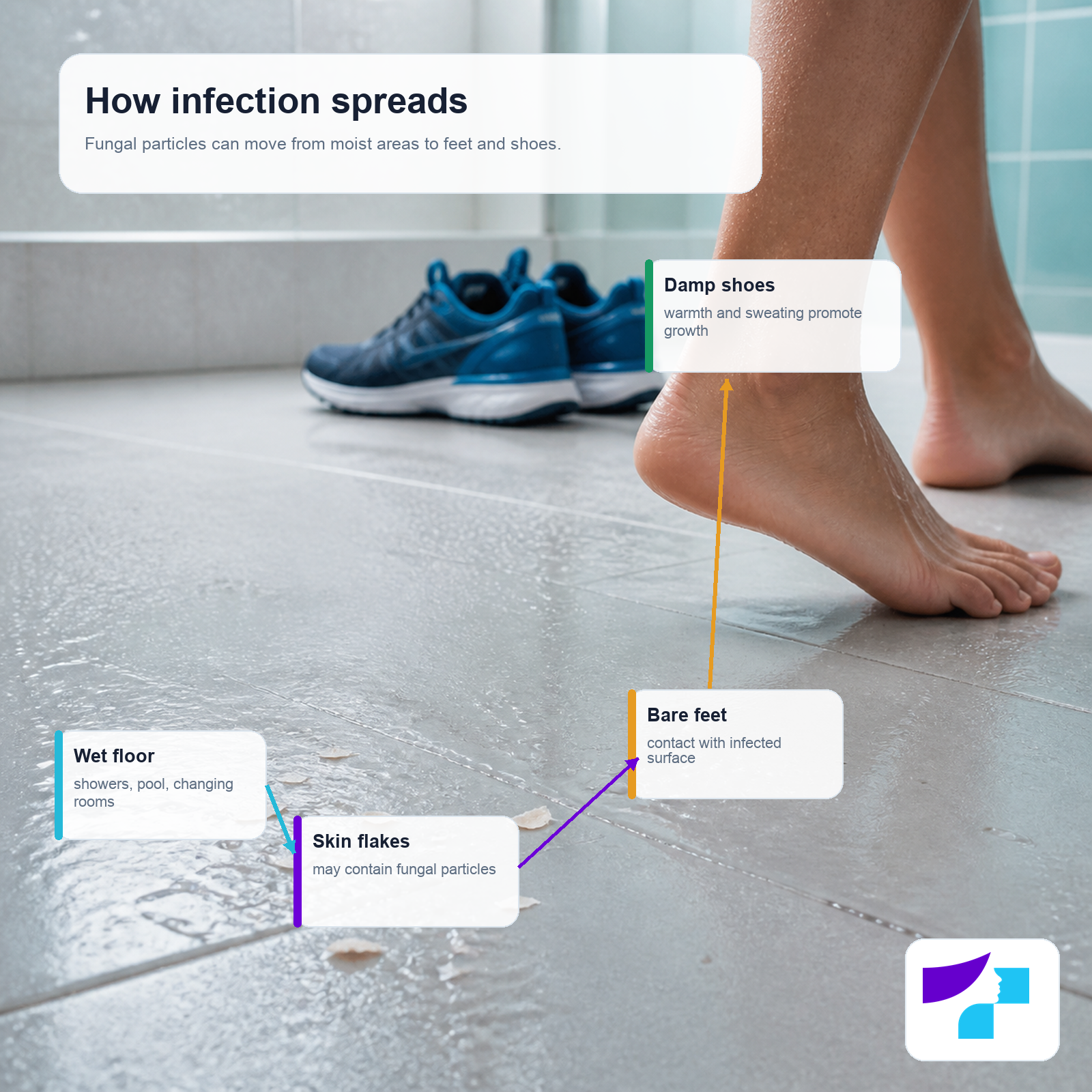 How athlete’s foot infection spreads: wet floor, skin flakes, bare feet and damp shoes