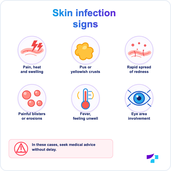 Skin infection signs in atopic dermatitis Signs of skin infection in atopic dermatitis: pain, pus, crusts, blisters and fever