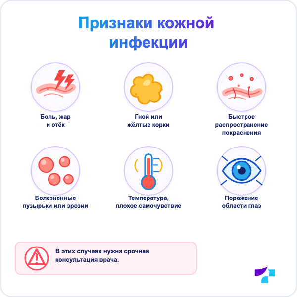 Признаки инфекции кожи при атопическом дерматите: боль, гной, корки, пузырьки и температура
