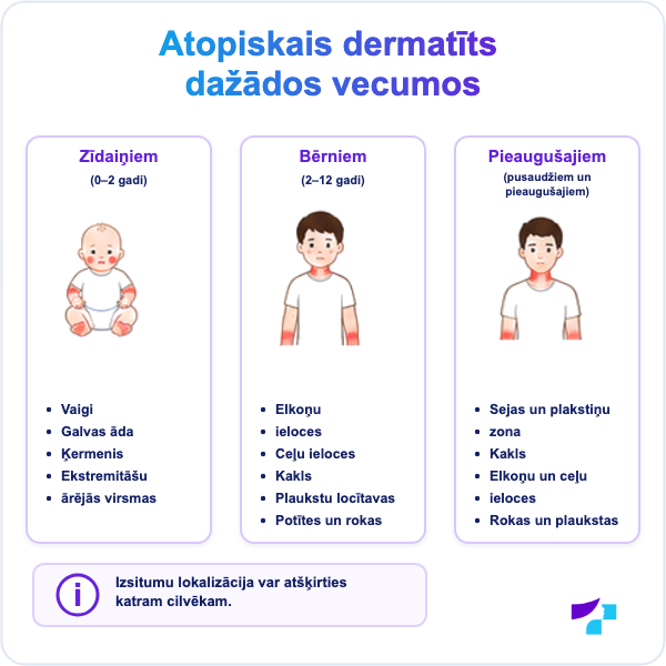 Atopiskā dermatīta biežākās atrašanās vietas zīdaiņiem, bērniem un pieaugušajiem