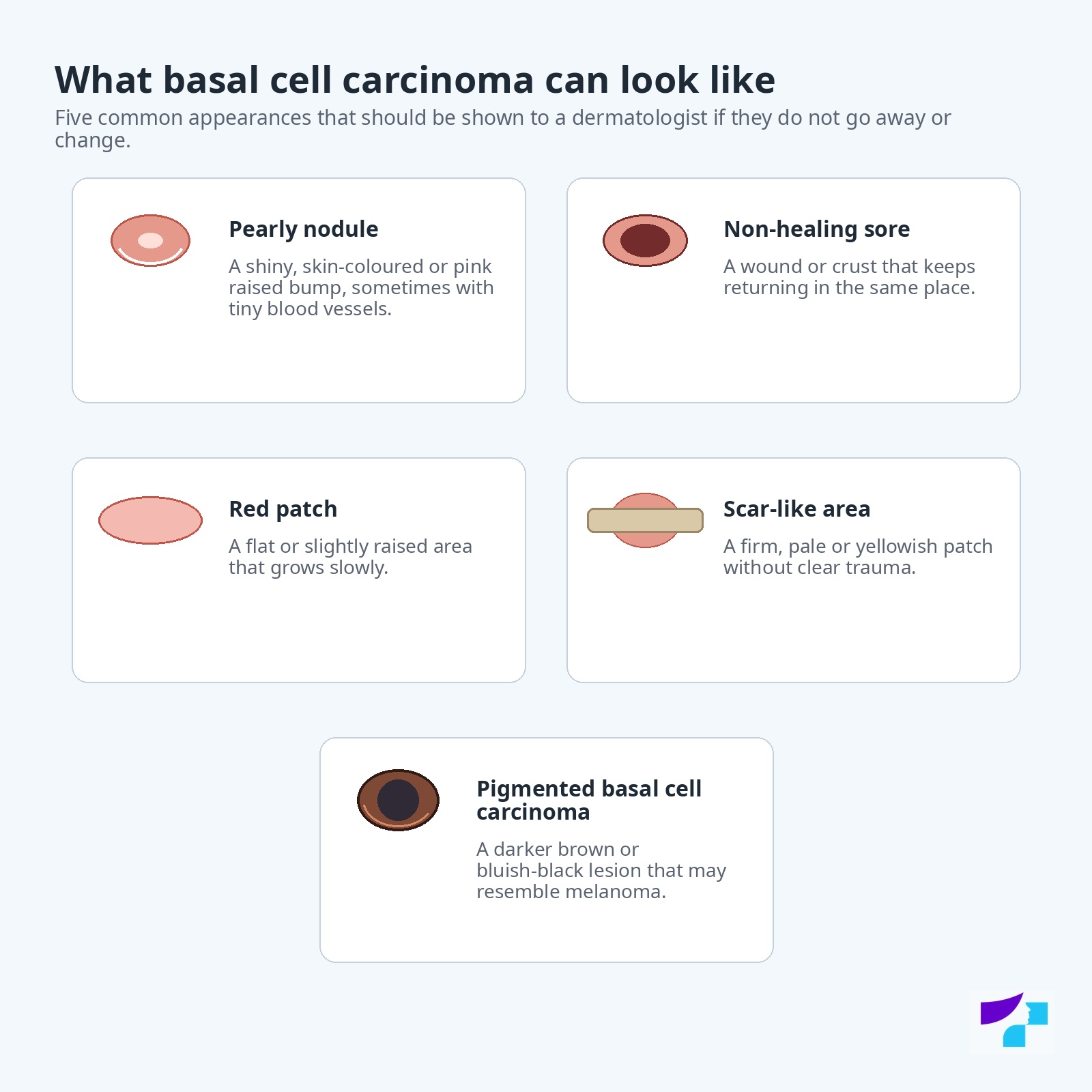 Typical appearances of basal cell carcinoma: pearly nodule, non-healing sore, red patch, scar-like area and pigmented basal cell carcinoma