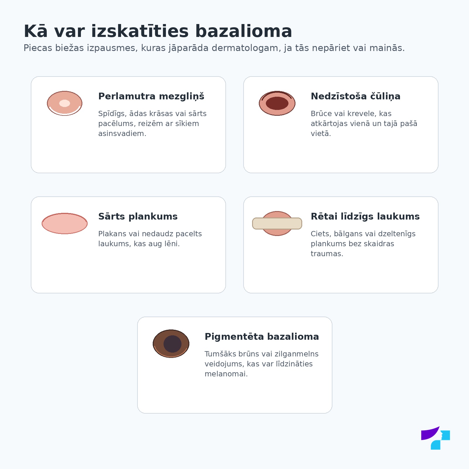 Bazaliomas tipiskās izpausmes: perlamutra mezgliņš, nedzīstoša čūliņa, sārts plankums, rētai līdzīgs laukums un pigmentēta bazalioma