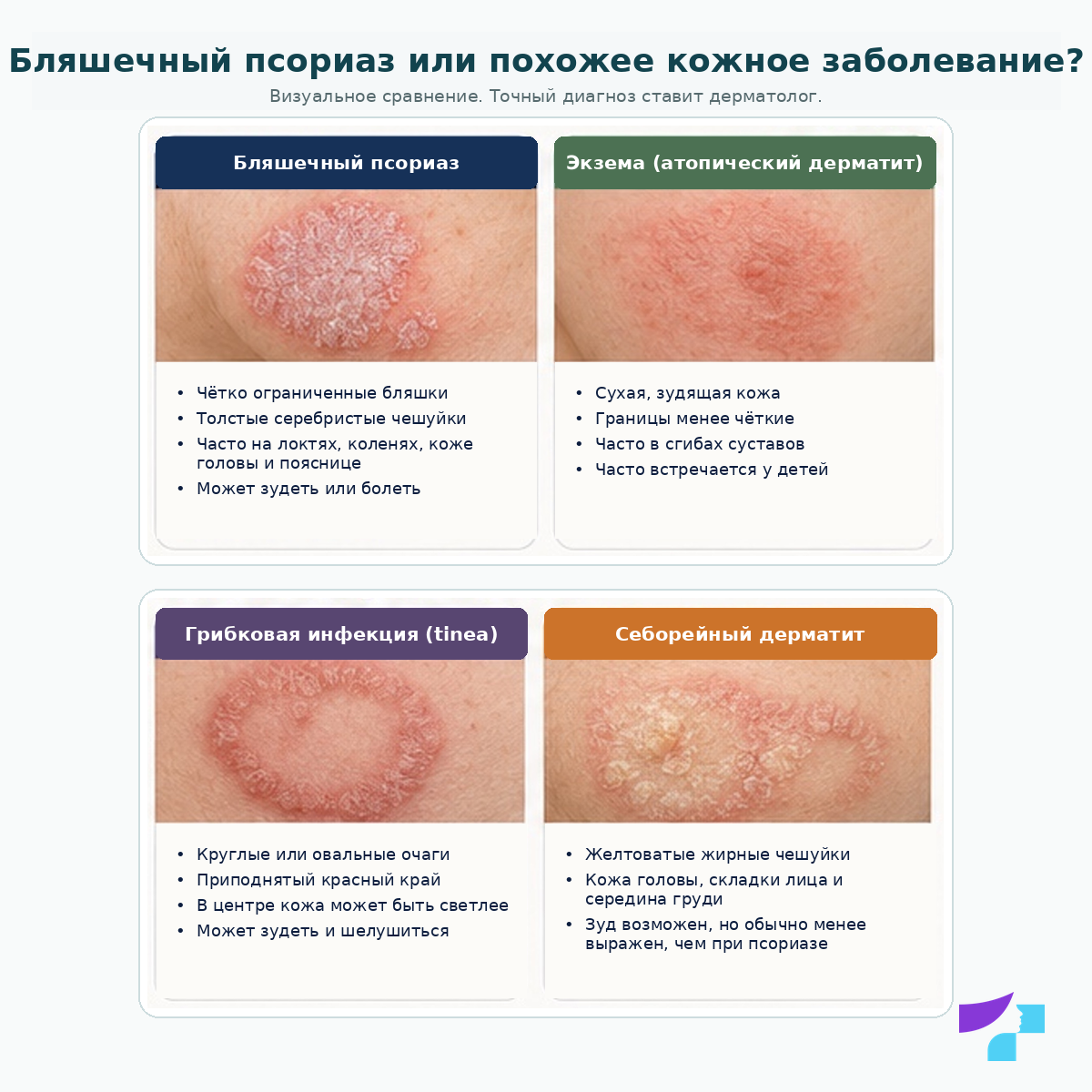 Бляшечный псориаз или похожее кожное заболевание Бляшечный псориаз или похожее кожное заболевание: сравнение с экземой, грибковой инфекцией и себорейным дерматитом