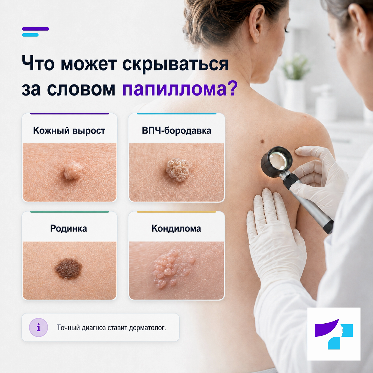 Что может скрываться за словом папиллома Что может скрываться за словом папиллома: кожный вырост, бородавка ВПЧ, родинка или кондилома