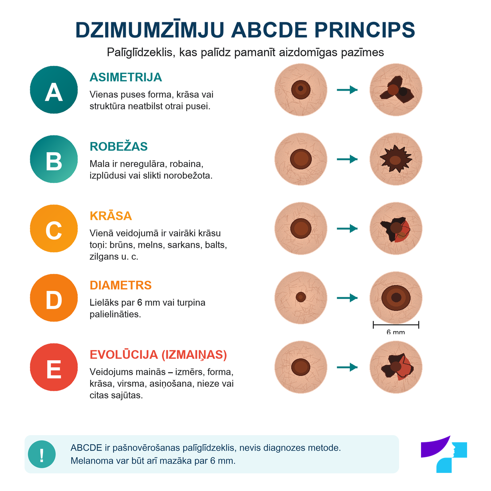 Dzimumzīmju ABCDE princips: asimetrija, robežas, krāsa, diametrs un izmaiņas