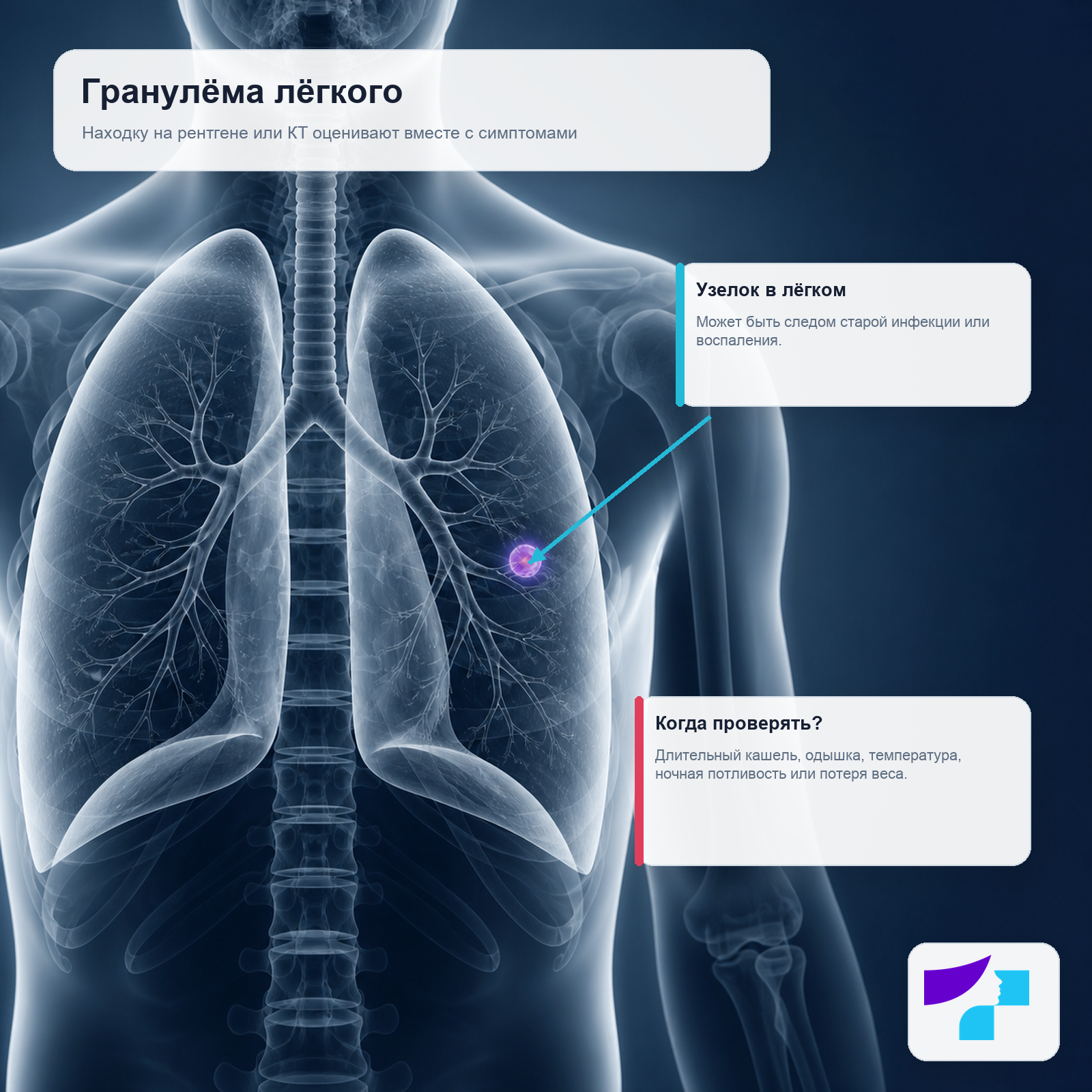 Гранулёма лёгкого как узелок в лёгком, обнаруженный на рентгене или КТ и оцениваемый вместе с симптомами