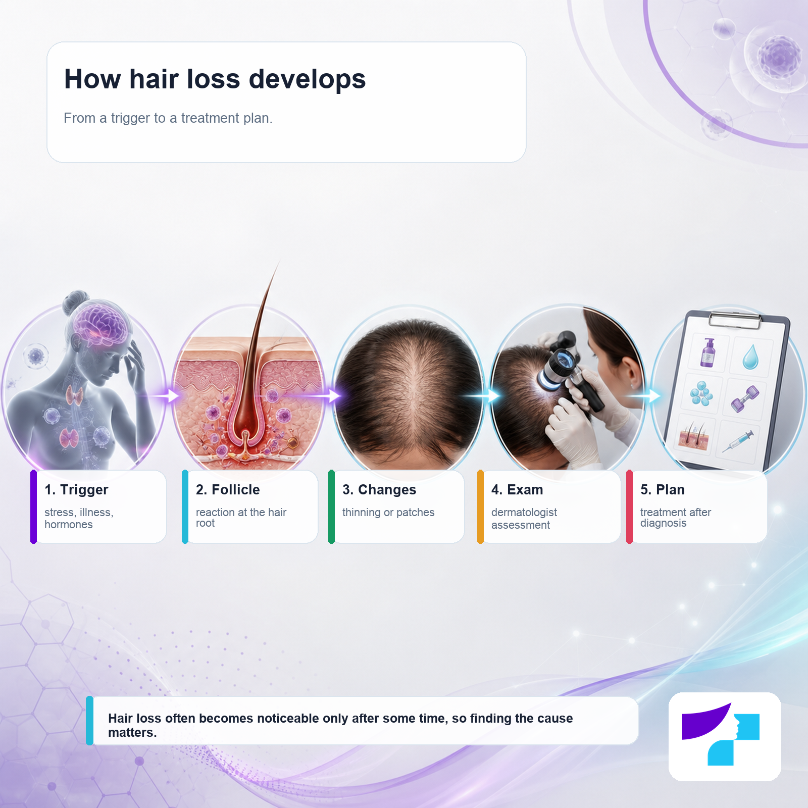Hair loss development timeline Hair loss development timeline from trigger to diagnosis and treatment plan