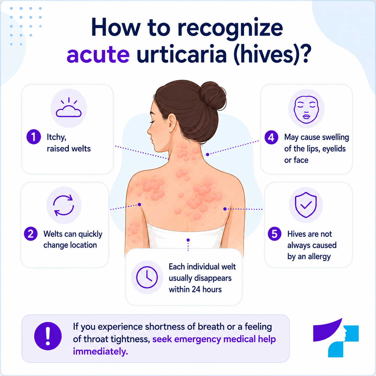 How to recognise acute urticaria or hives: itchy raised welts, rapidly changing location, swelling of the lips, eyelids or face, and individual welts usually disappearing within 24 hours