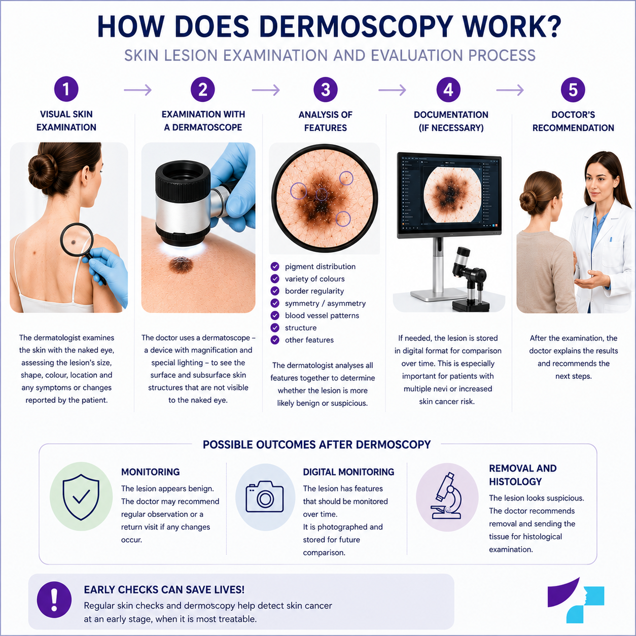 How dermoscopy works: visual skin examination, examination with a dermatoscope, feature analysis, documentation and doctor's recommendation