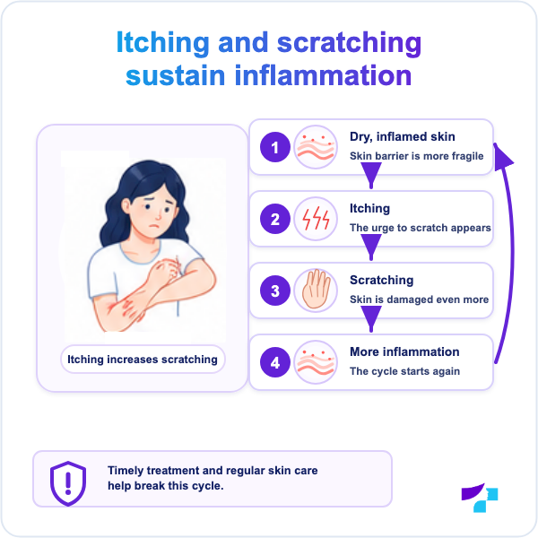 Itching and scratching sustain inflammation Atopic dermatitis itch-scratch cycle: itching, scratching, barrier damage and increased inflammation