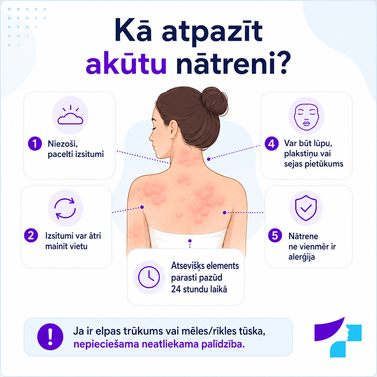 Kā atpazīt akūtu nātreni: niezoši, pacelti izsitumi, kas var ātri mainīt vietu un parasti pazūd 24 stundu laikā