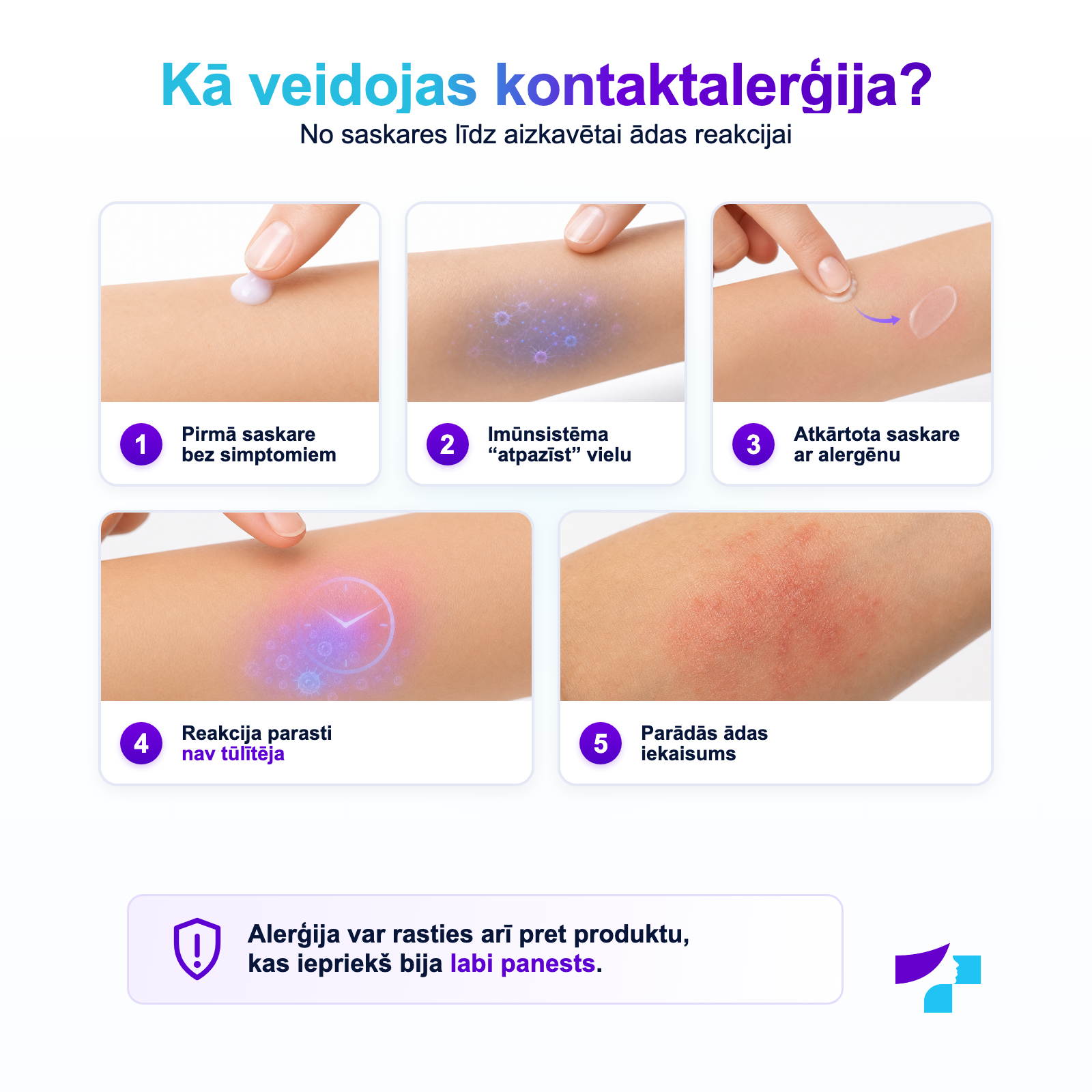 Kā veidojas kontaktalerģija Kā veidojas kontaktalerģija: sensibilizācija, atkārtota saskare ar alergēnu un aizkavēta ādas reakcija