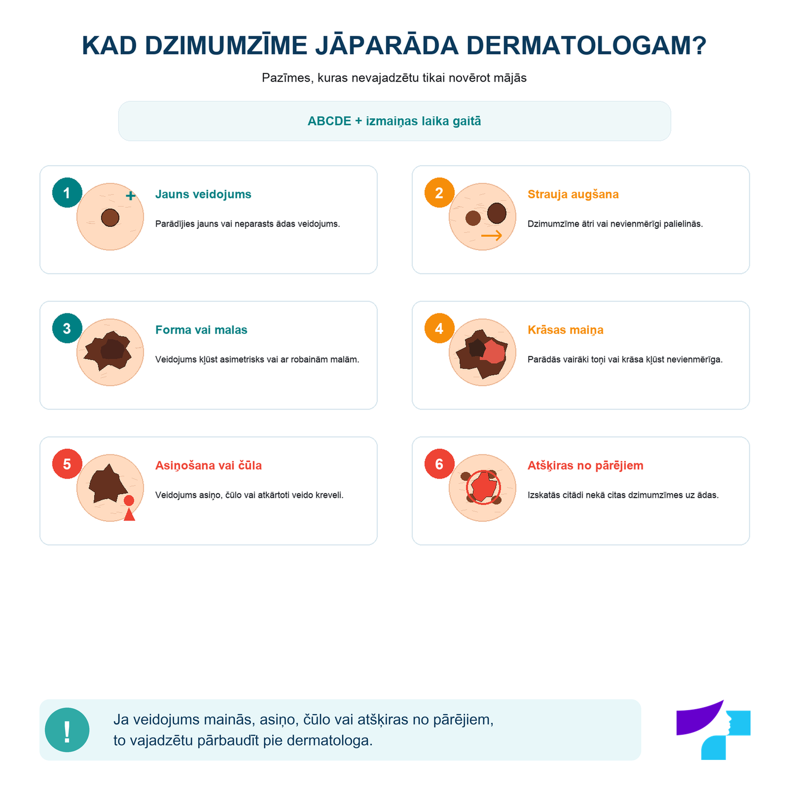 Pazīmes, kad dzimumzīme jāparāda dermatologam