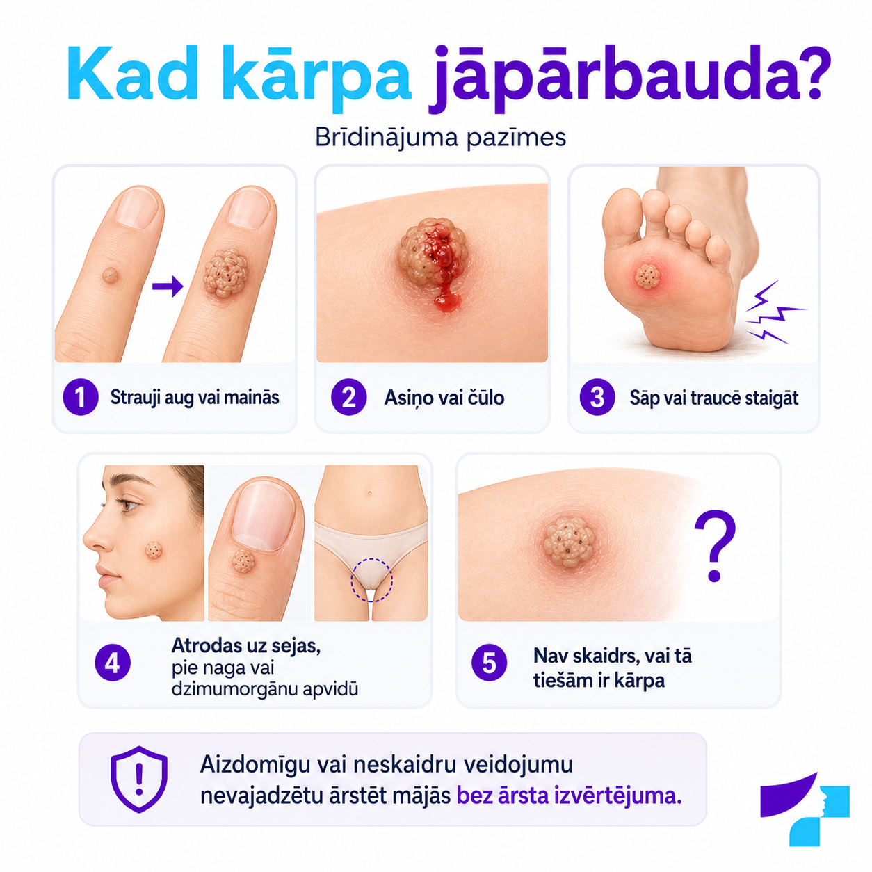 Kad kārpa jāpārbauda Kad kārpa jāpārbauda pie dermatologa: strauja augšana, asiņošana, sāpes, atrašanās uz sejas, pie naga vai dzimumorgānu apvidū un neskaidrs veidojums