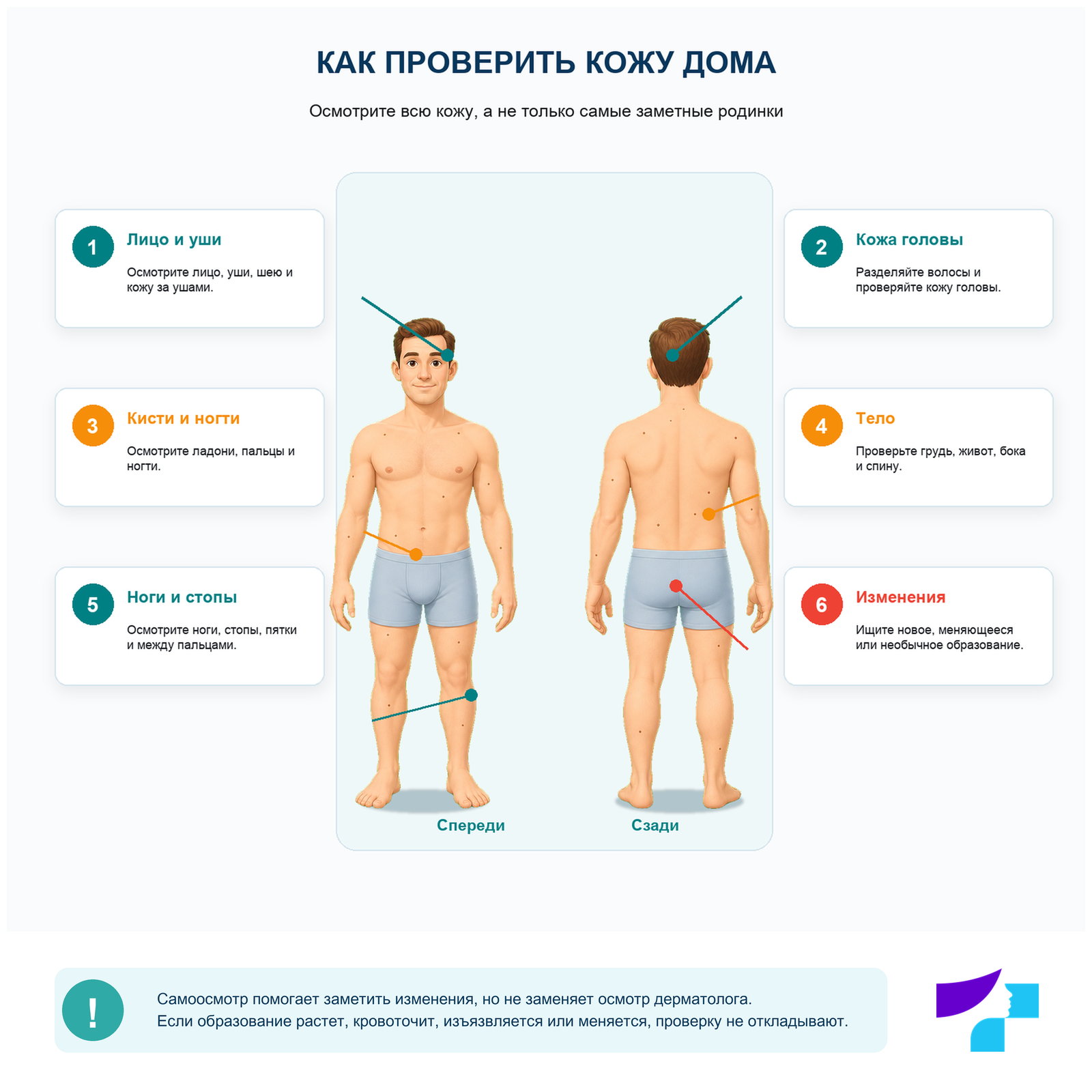 Как проверять родинки дома