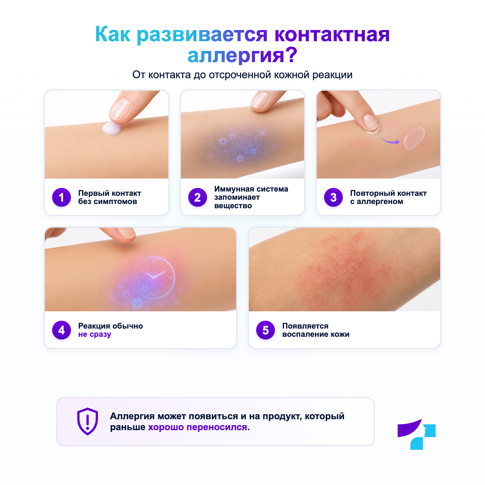Как развивается контактная аллергия Как развивается контактная аллергия: сенсибилизация, повторный контакт с аллергеном и отсроченная кожная реакция