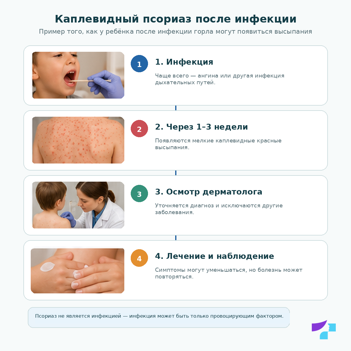 Каплевидный псориаз у детей после инфекции Каплевидный псориаз у детей после инфекции: воспаление горла или ангина могут провоцировать многочисленные мелкие каплевидные высыпания