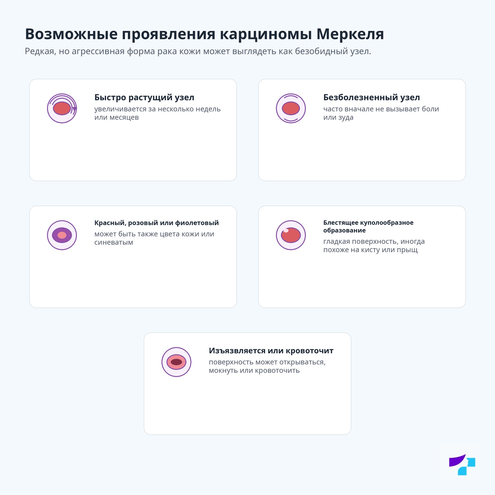 Возможные проявления карциномы Меркеля Возможные проявления карциномы Меркеля: быстро растущий узел, безболезненный узел, красный розовый или фиолетовый узел, блестящее куполообразное образование и изъязвляющийся или кровоточащий узел