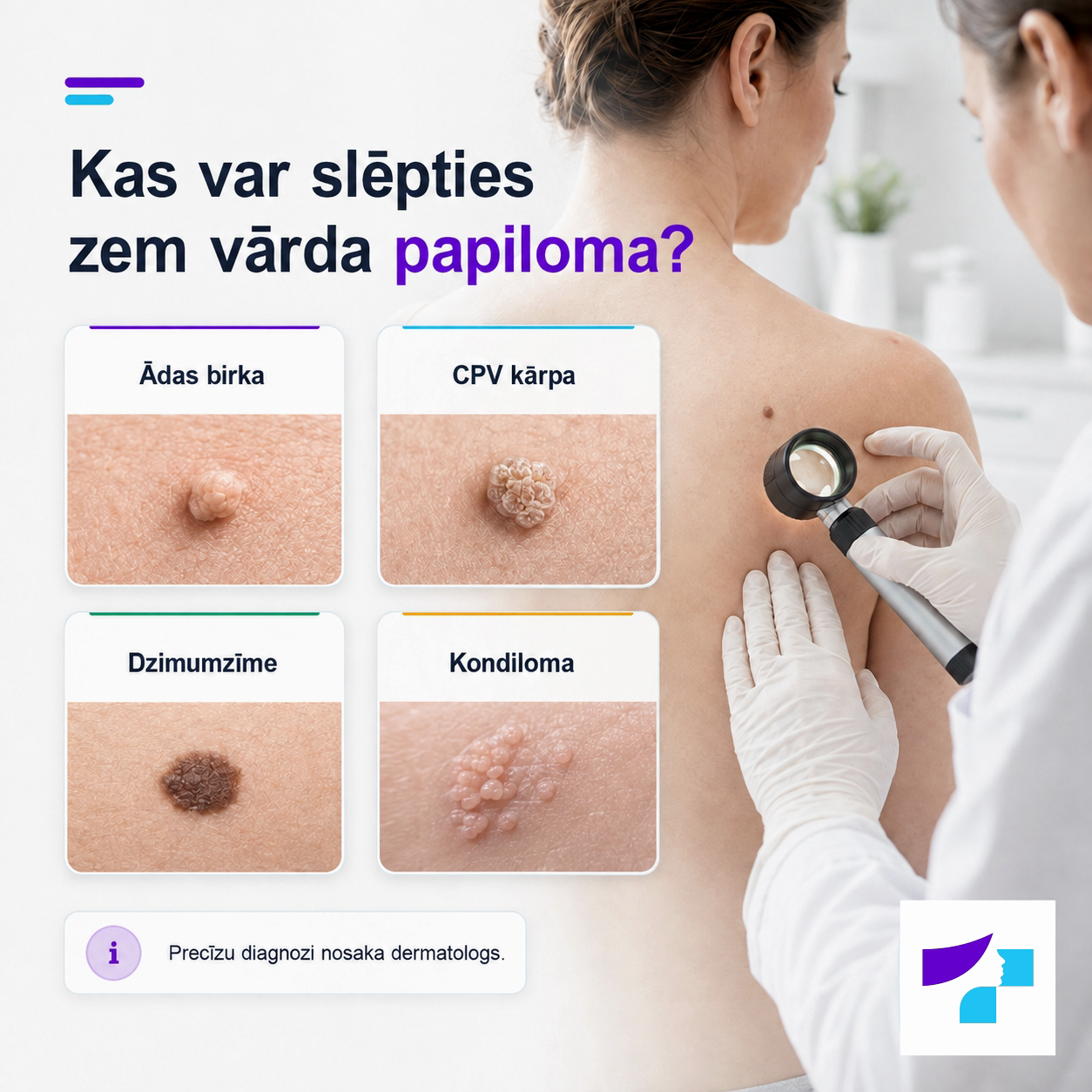 Kas var slēpties zem vārda papiloma Kas var slēpties zem vārda papiloma: ādas birka, CPV kārpa, dzimumzīme vai kondiloma