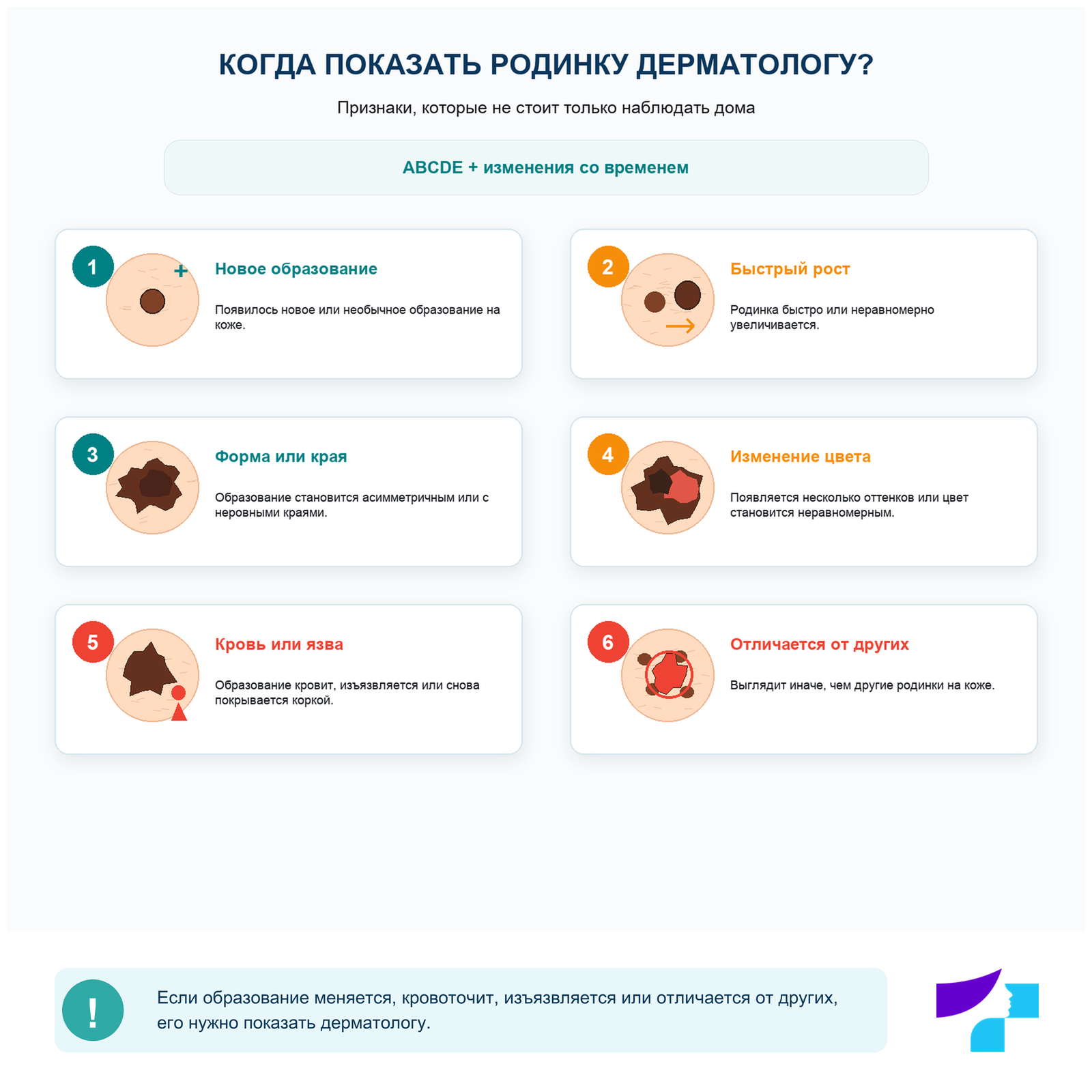 Когда родинку нужно показать дерматологу