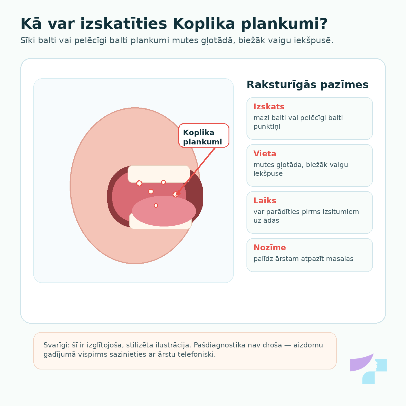 Koplika plankumi masalu gadījumā Koplika plankumi masalu gadījumā: sīki balti plankumi mutes gļotādā