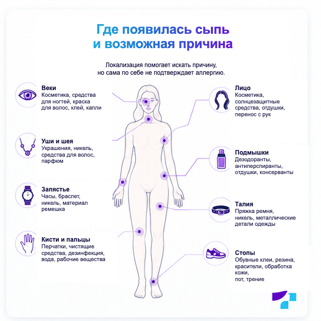 Локализация сыпи и возможная причина Локализация контактной сыпи и возможные причины