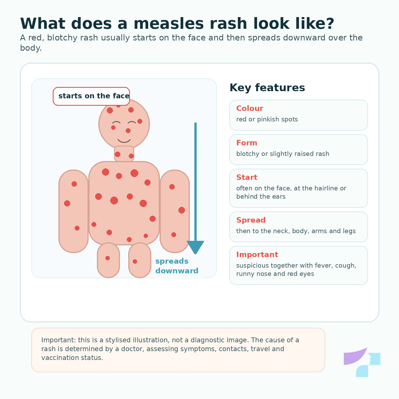 Measles rash: red blotchy rash that starts on the face and spreads downward over the body