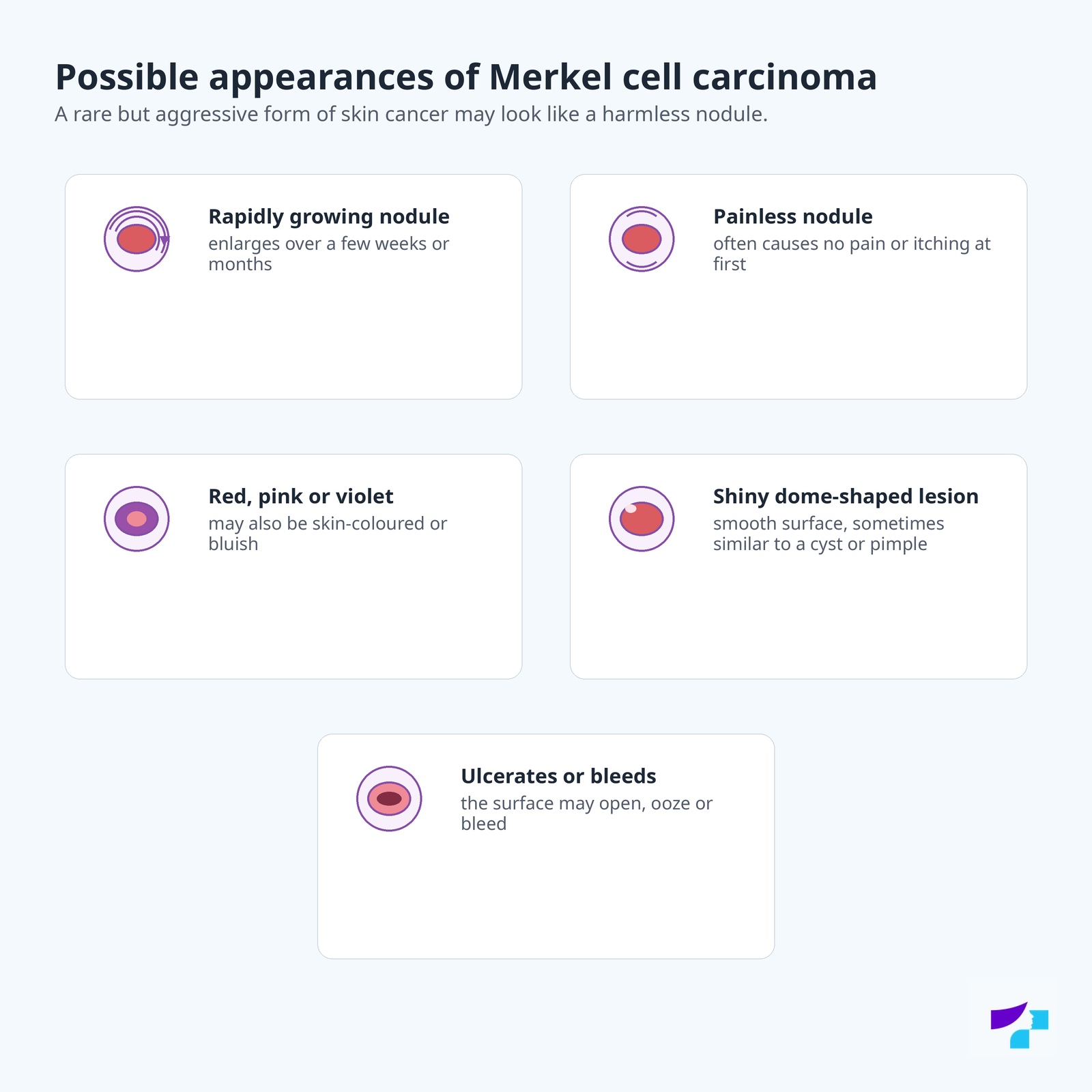 Possible appearances of Merkel cell carcinoma: rapidly growing nodule, painless nodule, red pink or violet nodule, shiny dome-shaped lesion and ulcerating or bleeding nodule
