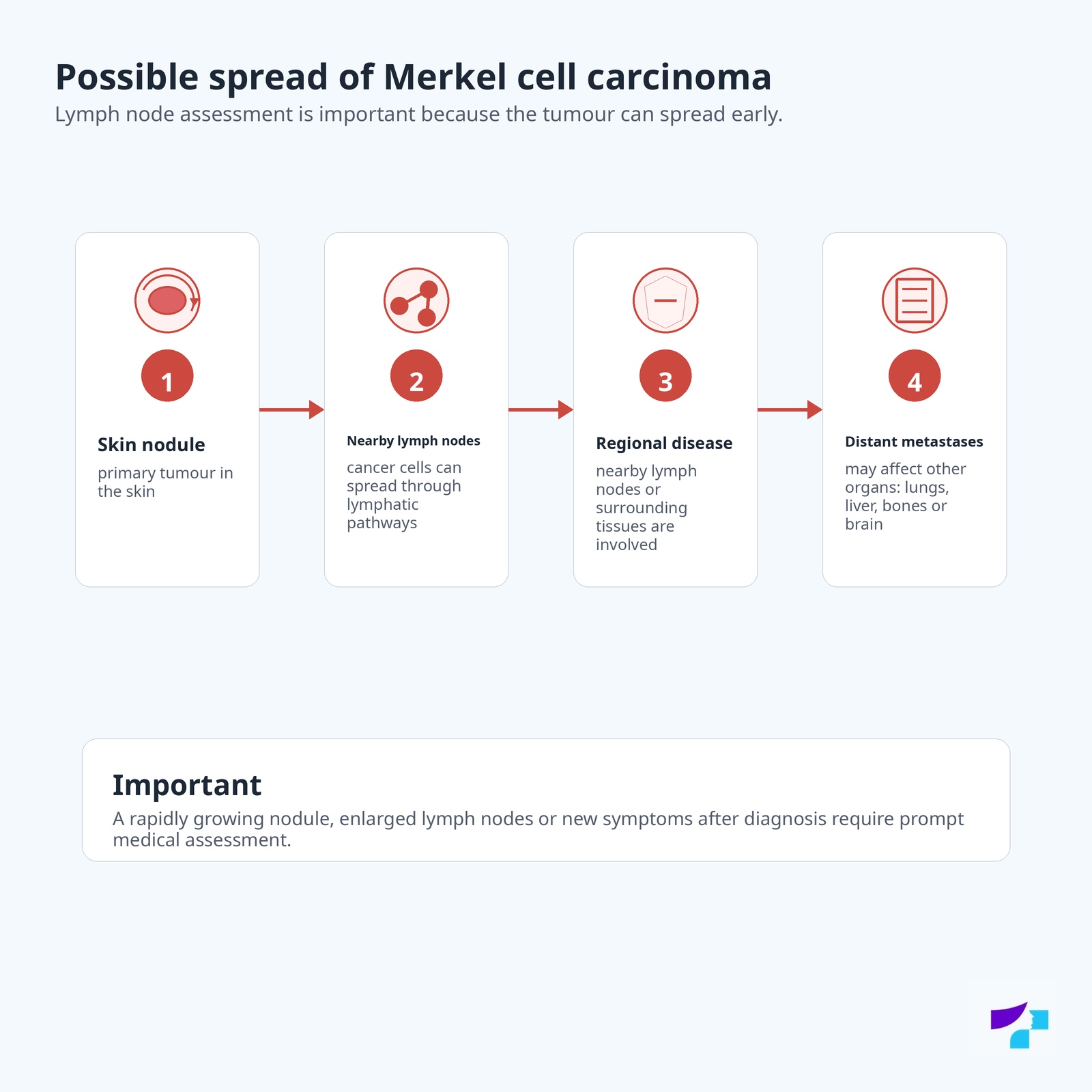 Possible spread of Merkel cell carcinoma: skin nodule, nearby lymph nodes, regional disease and distant metastases