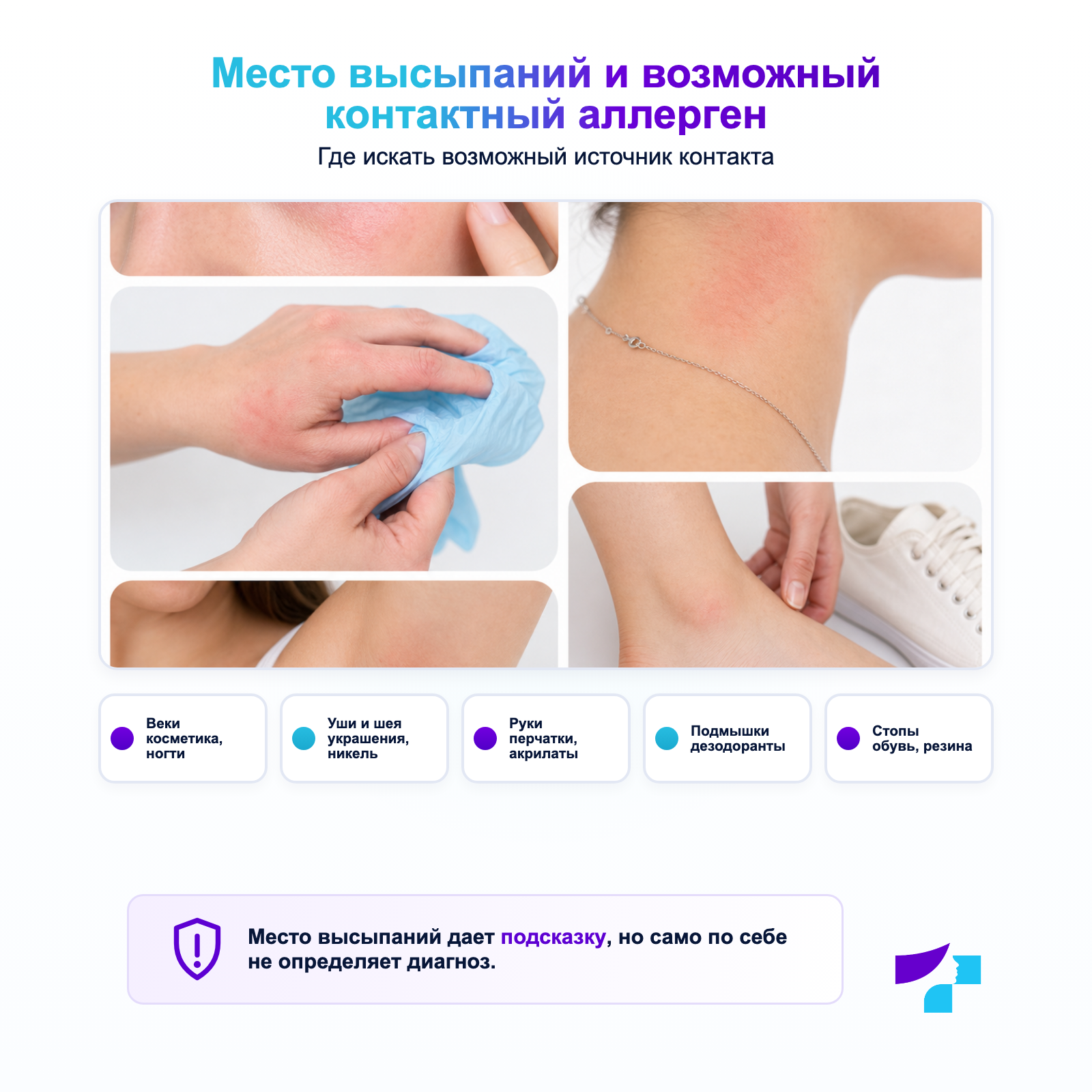 Место высыпаний и возможный контактный аллерген Локализация контактного дерматита и возможные аллергены на руках, веках, ушах, шее и стопах