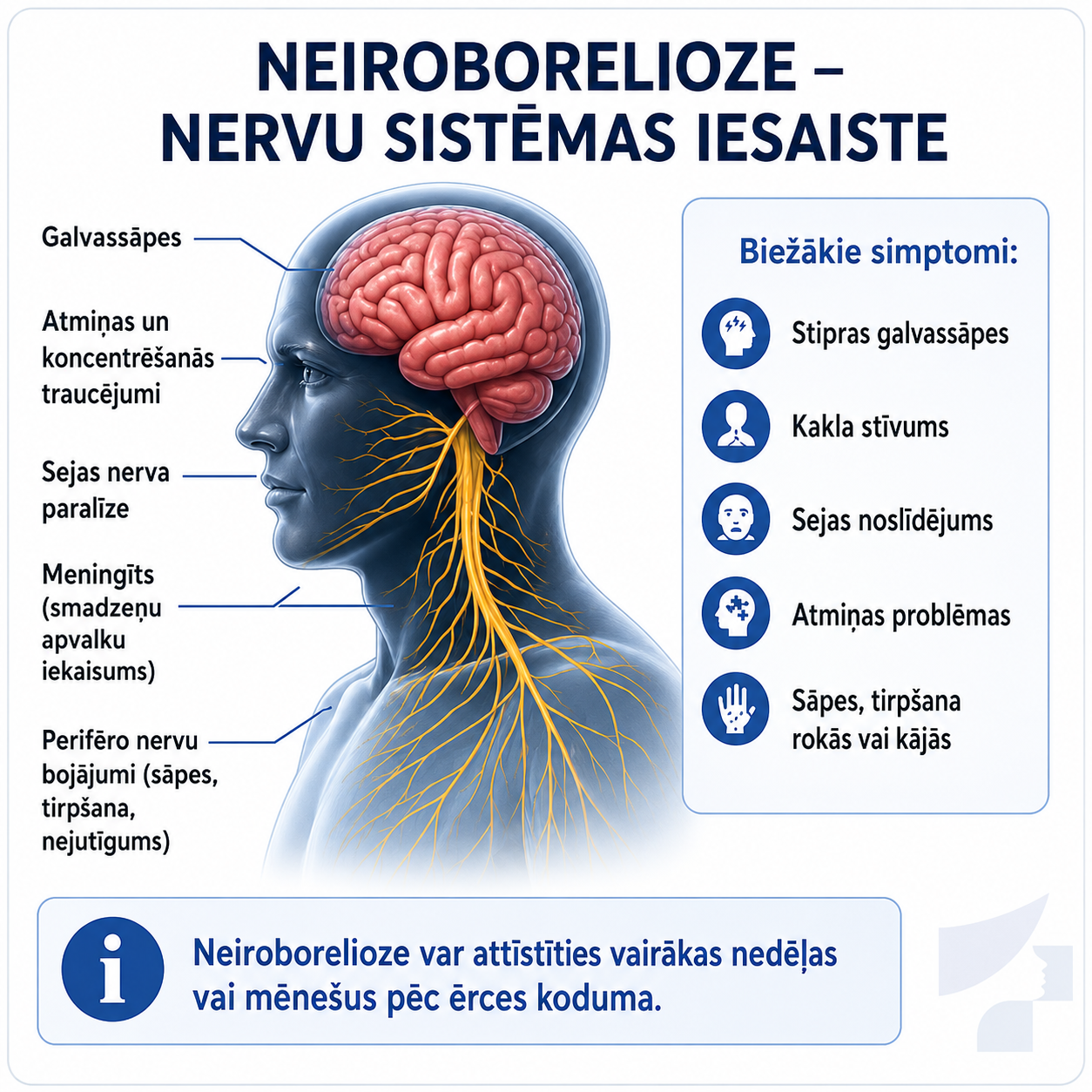 Neiroboreliozes ilustrācija