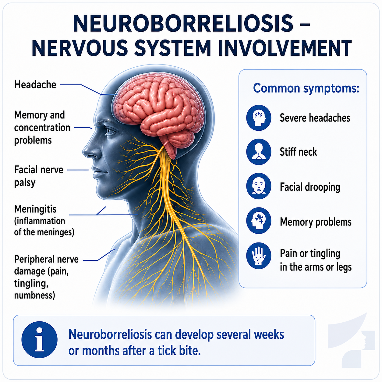 Neuroborreliosis illustration