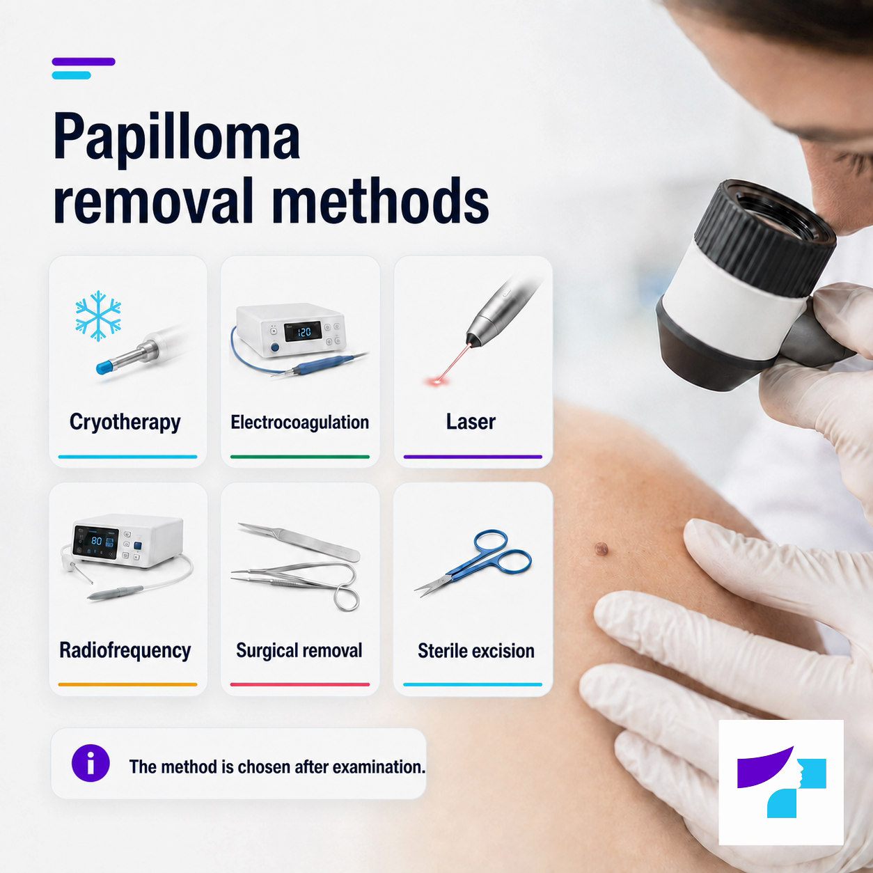 Papilloma removal methods Papilloma removal methods: cryotherapy, electrocoagulation, laser therapy, radiofrequency, surgical removal and sterile removal with medical scissors