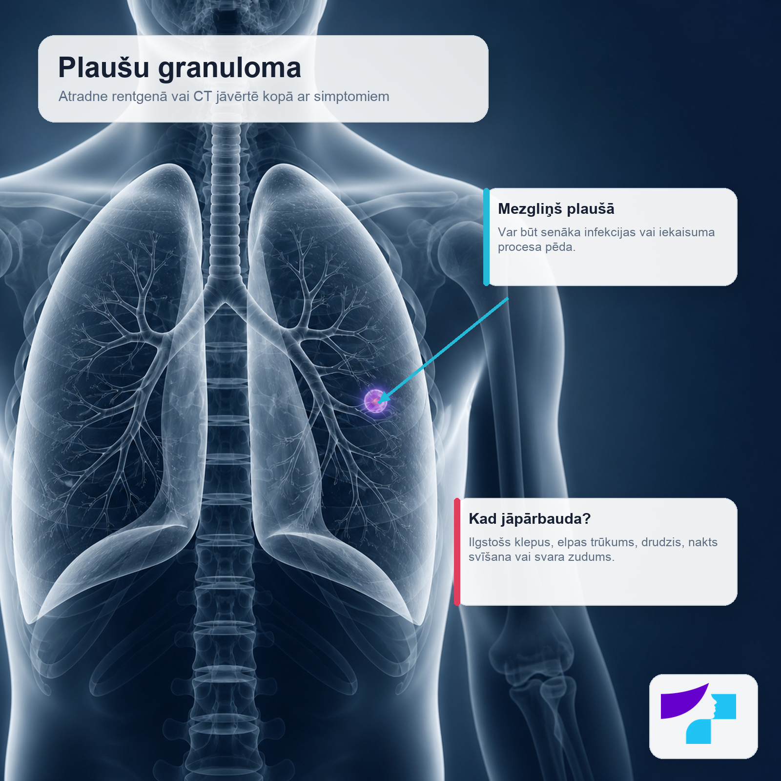 Plaušu granuloma rentgena vai CT kontekstā Plaušu granuloma kā mezgliņš plaušā, ko atrod rentgenā vai datortomogrāfijā un vērtē kopā ar simptomiem