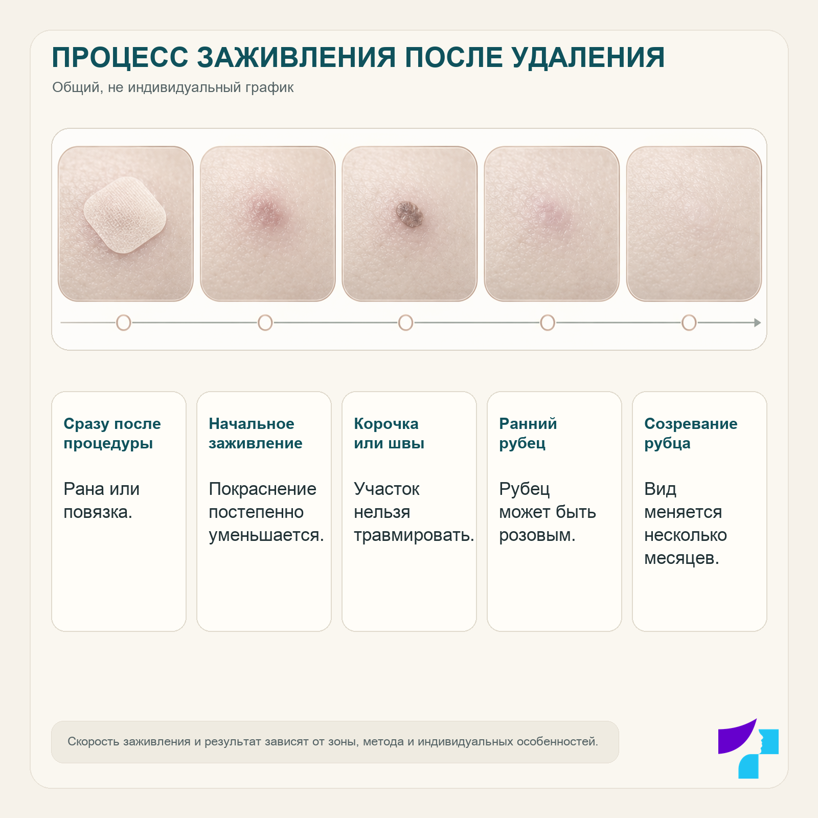 Процесс заживления после удаления родинки Процесс заживления после удаления родинки