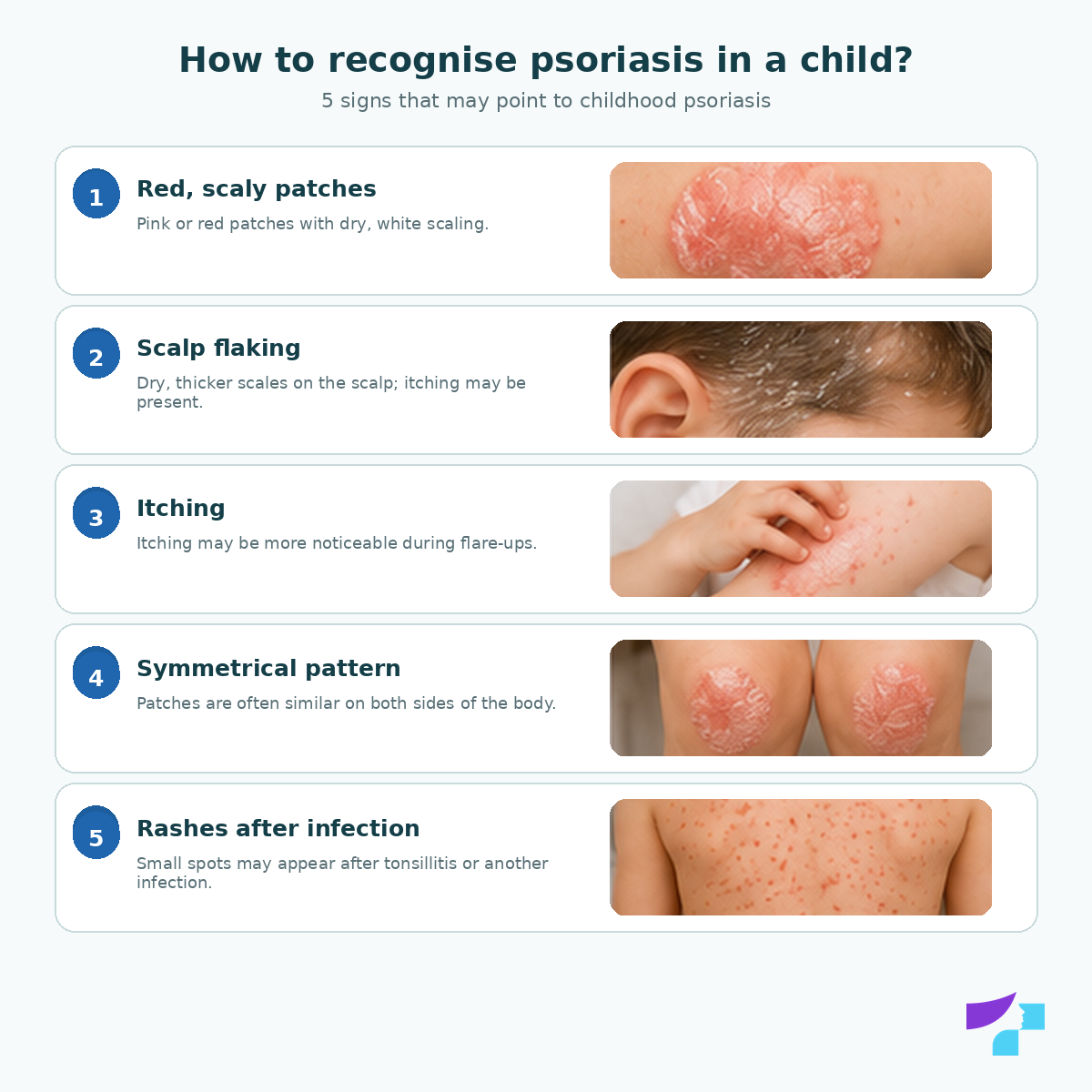 How to recognise psoriasis in children: scaly patches, scalp flaking, rashes after infection, nail changes and joint symptoms