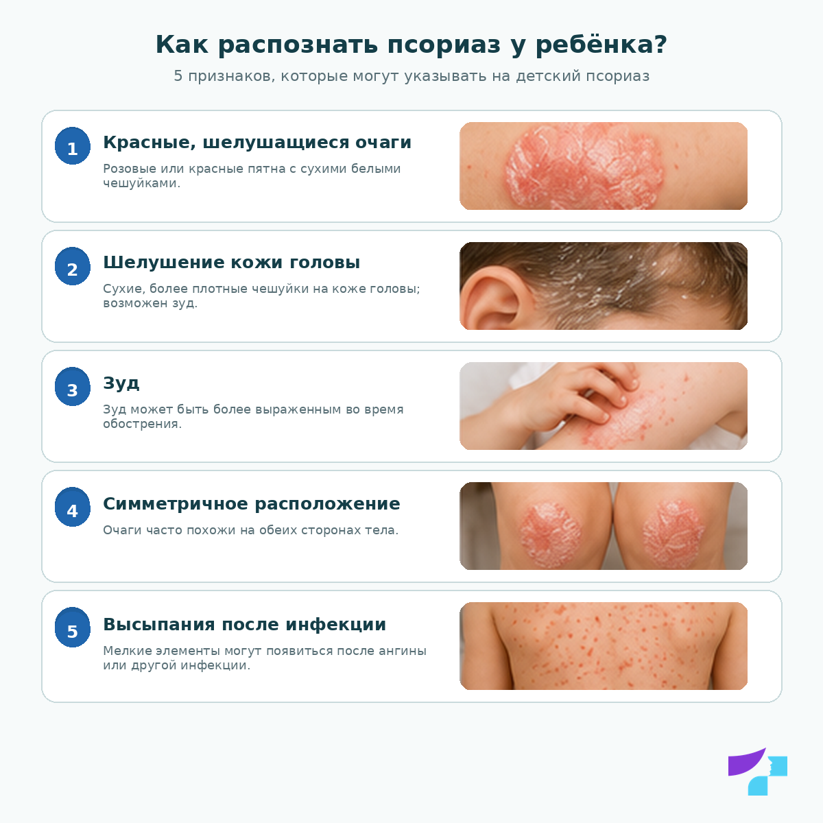 Как распознать псориаз у детей Как распознать псориаз у детей: шелушащиеся очаги, шелушение кожи головы, высыпания после инфекции, изменения ногтей и жалобы со стороны суставов