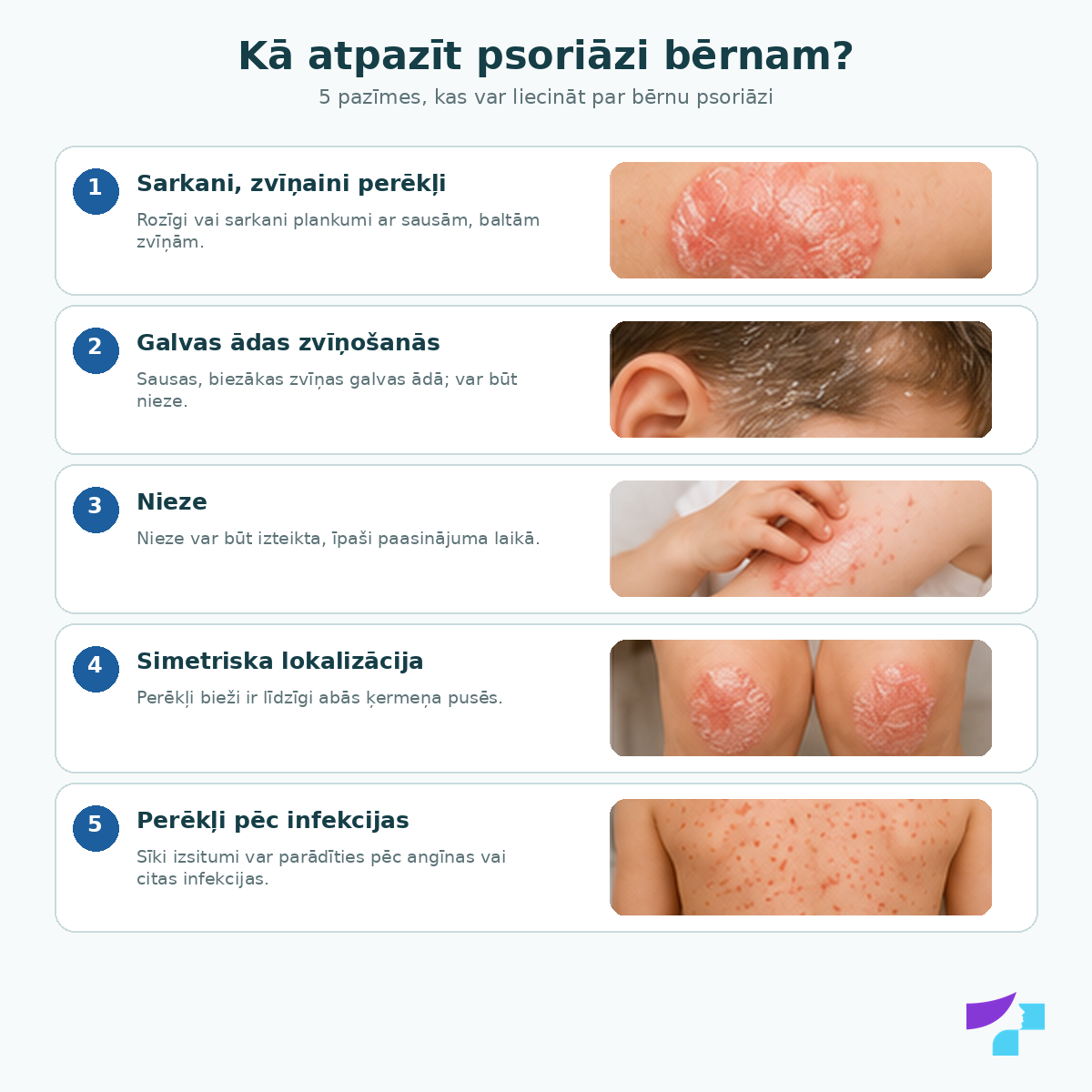 Kā atpazīt psoriāzi bērniem: zvīņaini perēkļi, galvas ādas lobīšanās, izsitumi pēc infekcijas, nagu izmaiņas un locītavu sūdzības