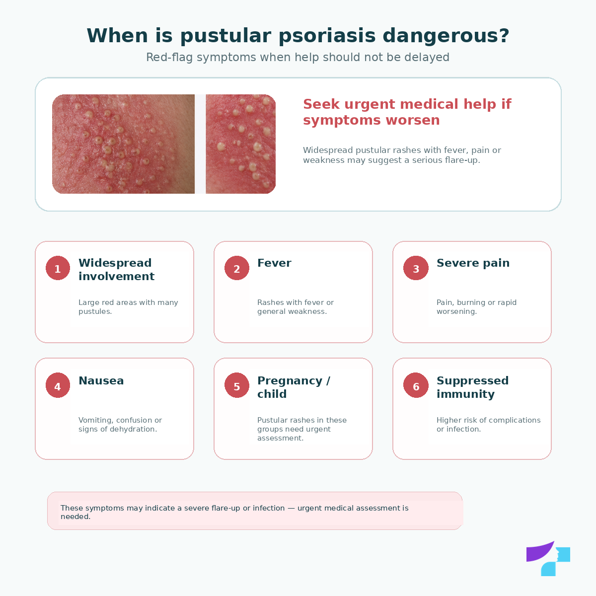 Pustular psoriasis: dangerous symptoms Pustular psoriasis and dangerous symptoms: fever, chills, weakness, severe pain, widespread skin involvement and rapid spread of pustules