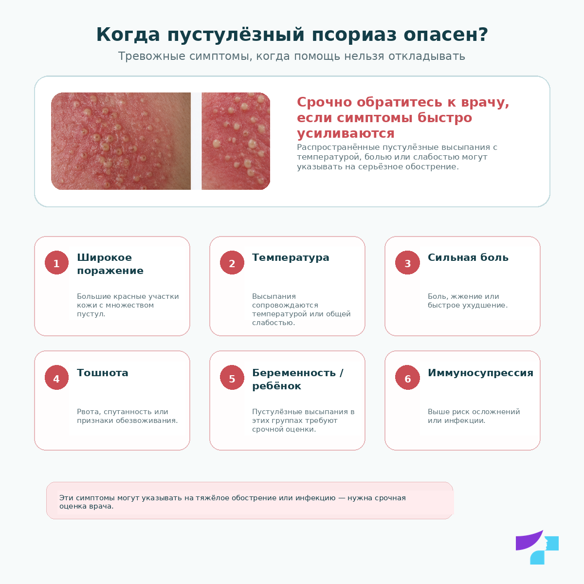 Пустулёзный псориаз и опасные симптомы: температура, озноб, слабость, сильная боль, обширное поражение кожи и быстрое распространение пустул