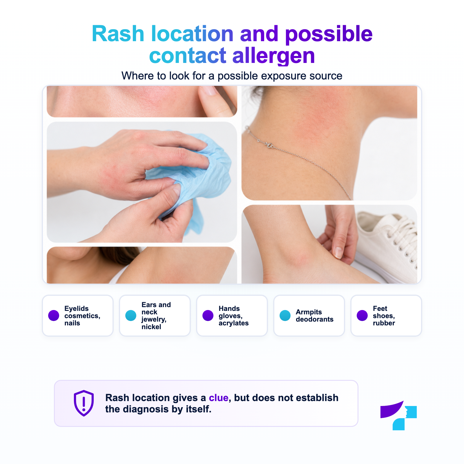 Contact dermatitis location and possible allergens on the hands, eyelids, ears, neck and feet