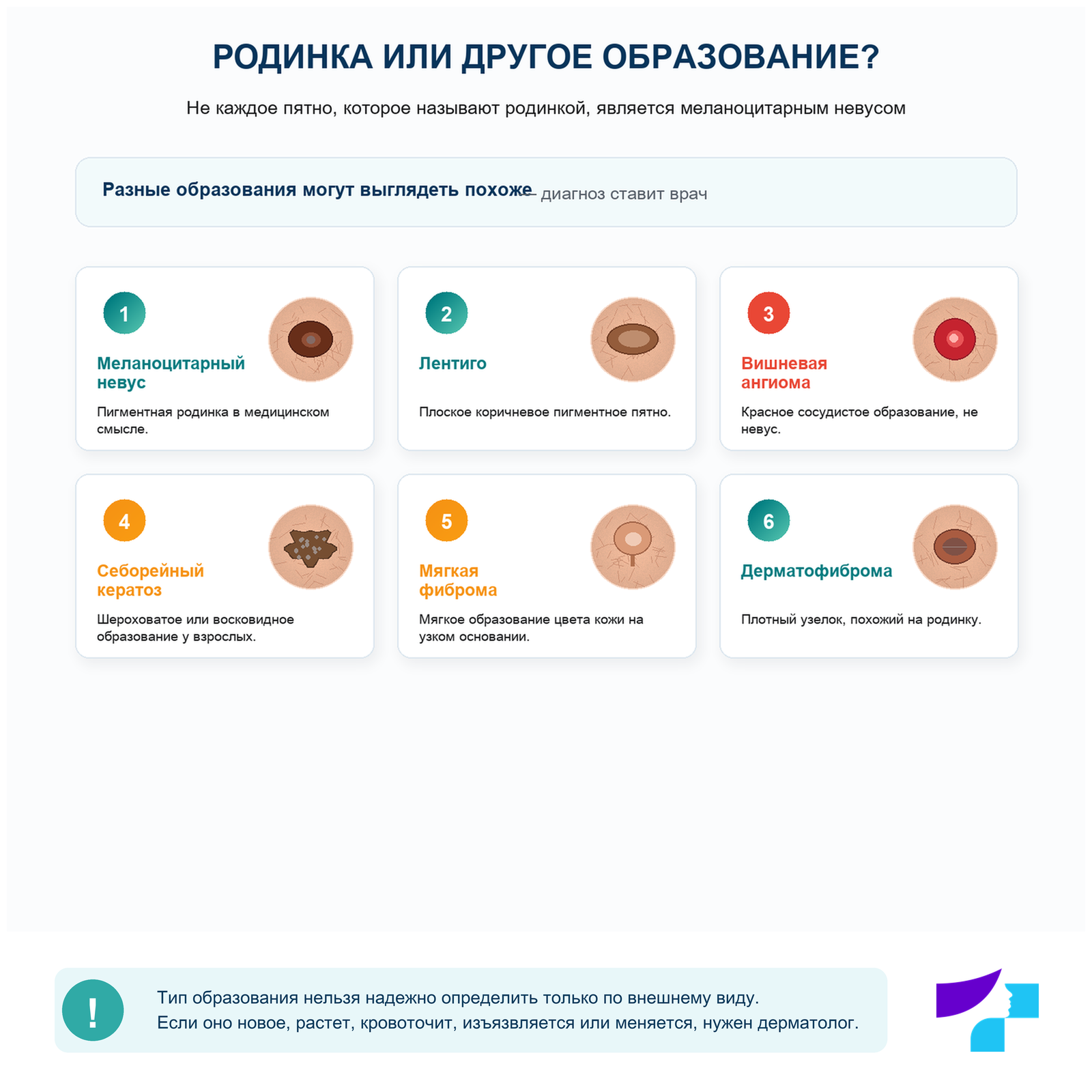Родинка или другое образование кожи
