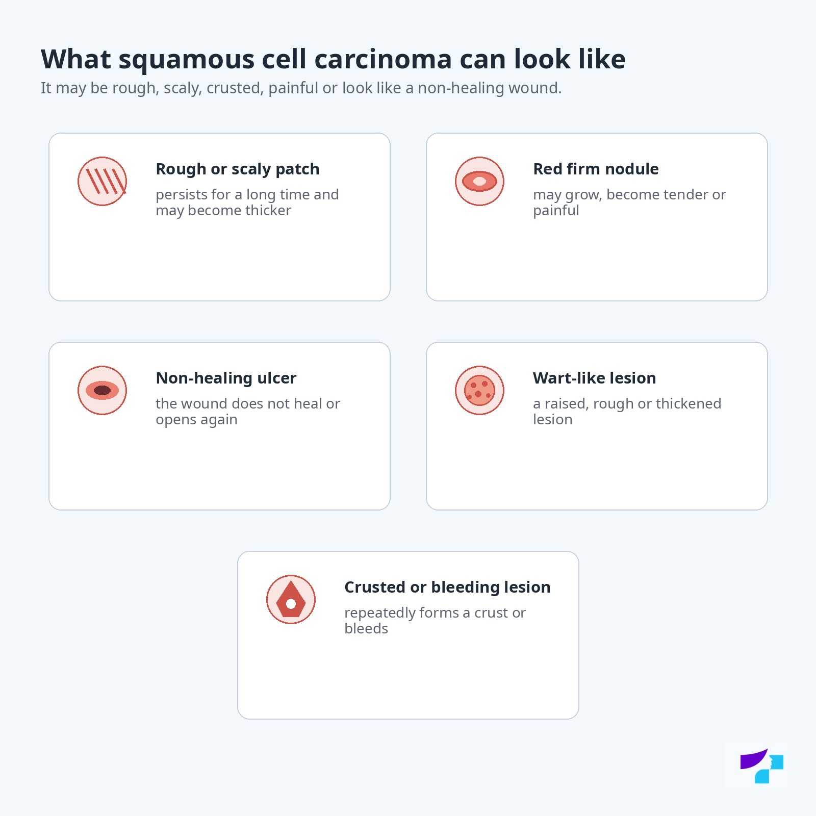 Possible appearances of squamous cell carcinoma: rough or scaly patch, red firm nodule, non-healing ulcer, wart-like lesion and crusted or bleeding lesion