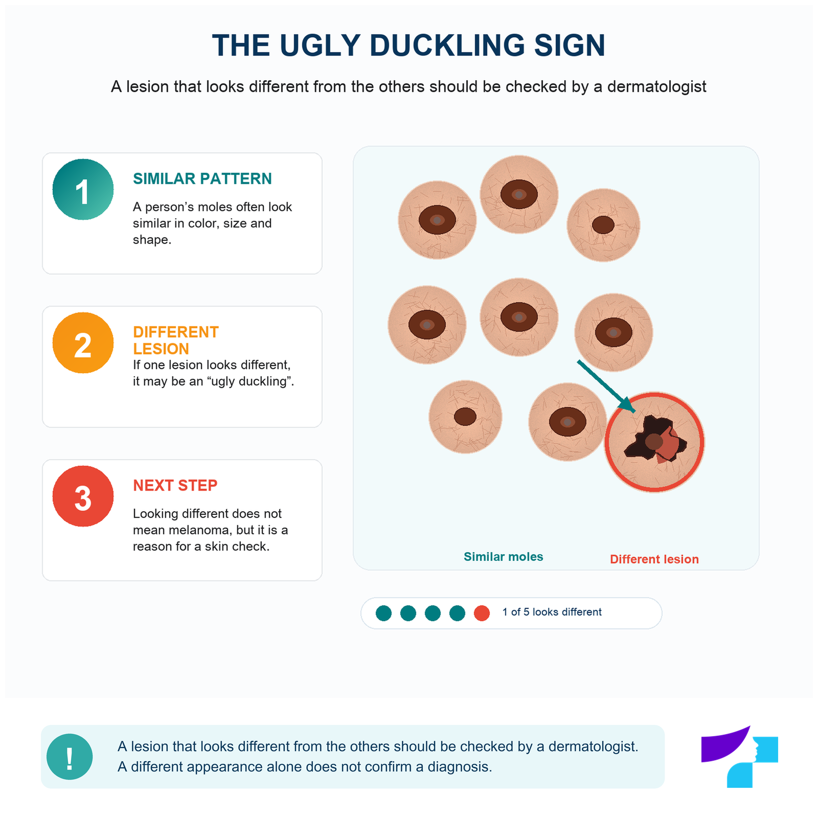 The ugly duckling sign in mole self-checking