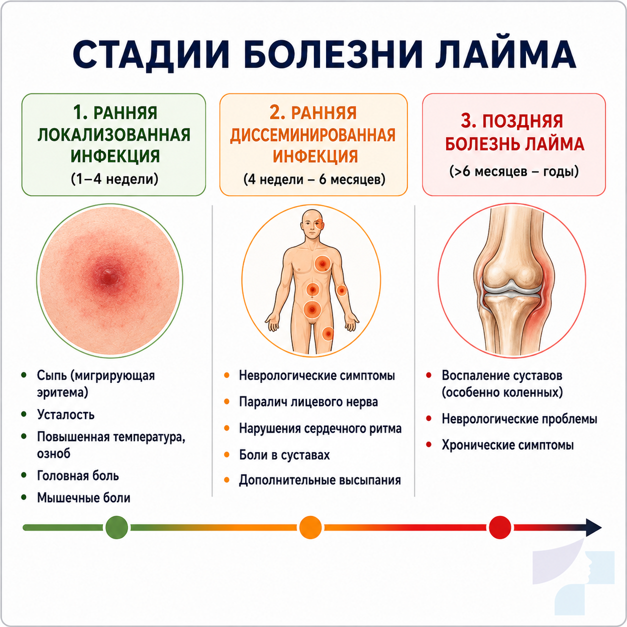 Визуализация стадий болезни Лайма