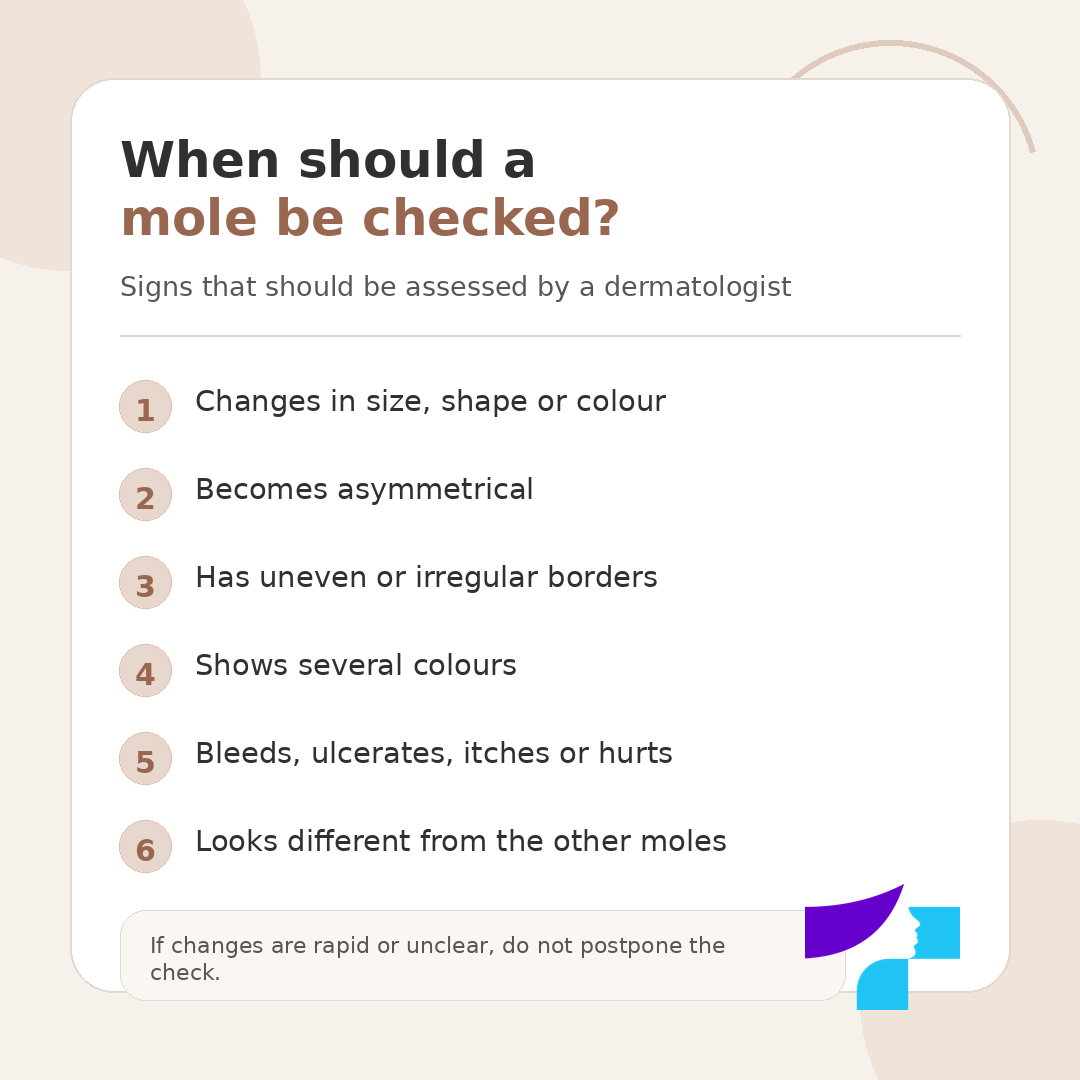 When should a mole be checked When should a mole be checked: changes in size, shape or colour, becomes asymmetrical, has uneven borders, shows several colours, bleeds, ulcerates, itches or hurts